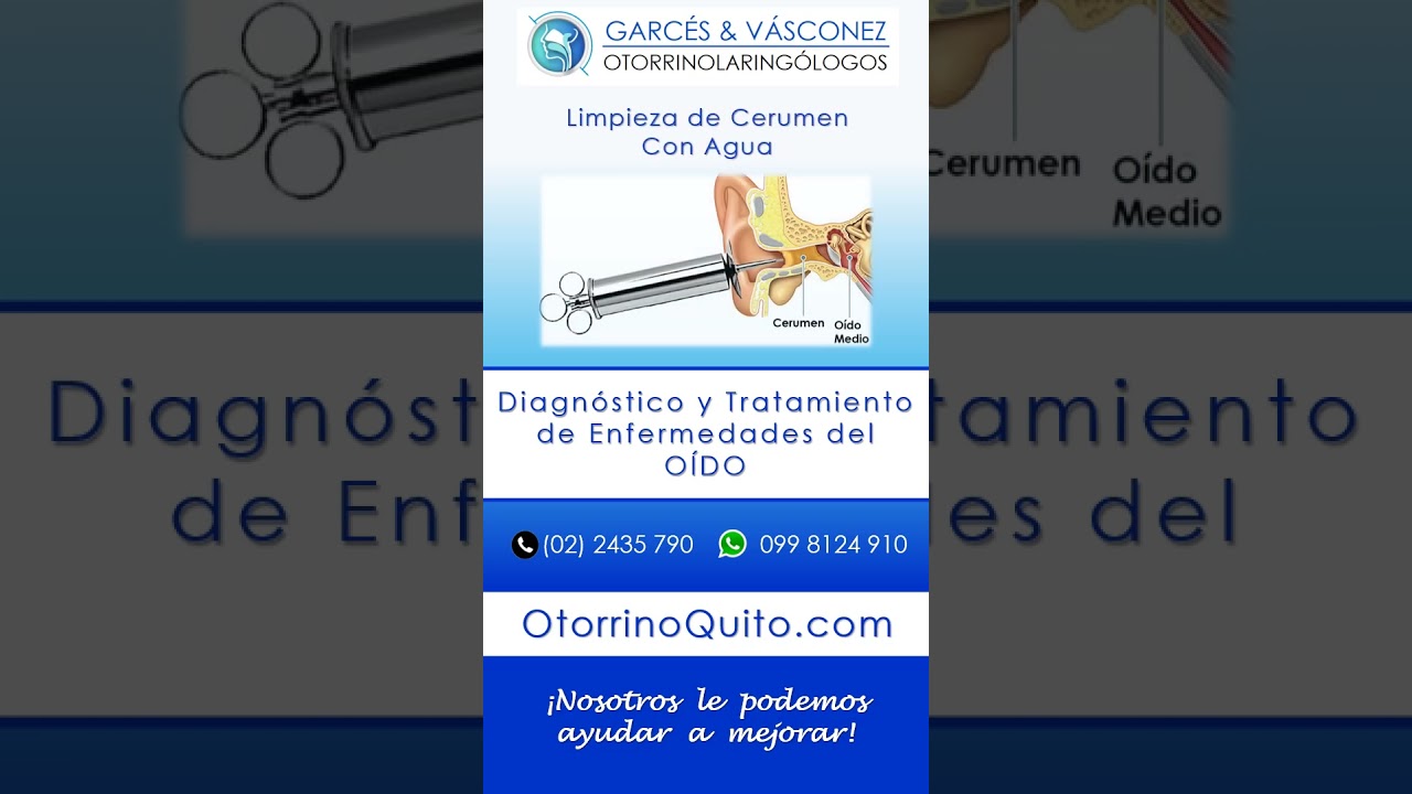 #OÍDO