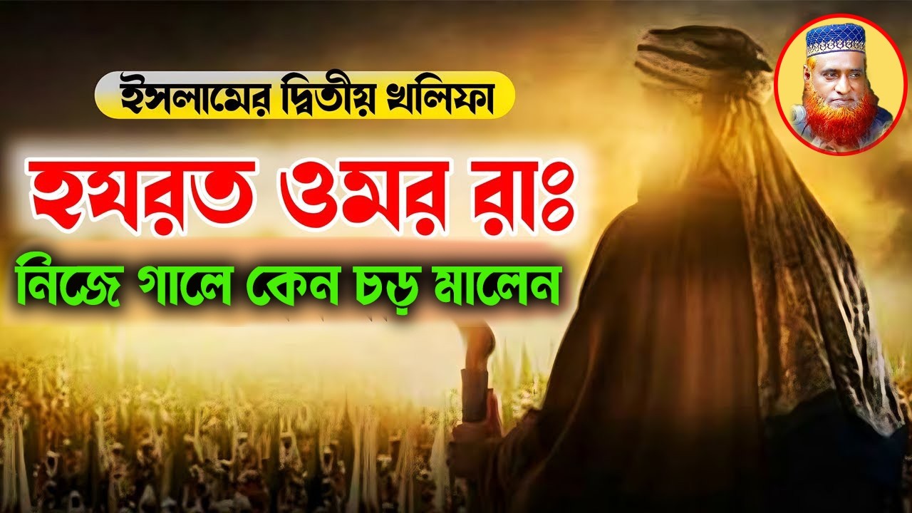 ওমর রাঃ কেন তার নিজের গালে নেই চড় মারতেছিলেন।