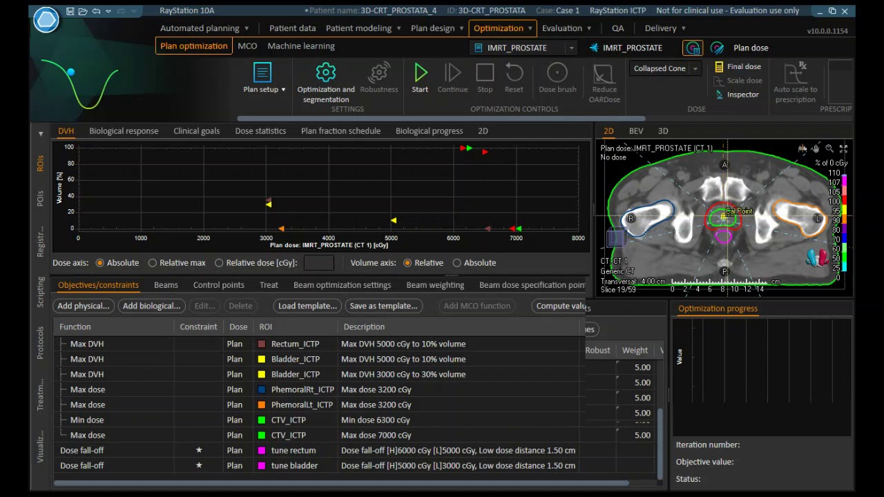 IMRT Prostate vs 3D planning with Raystation
