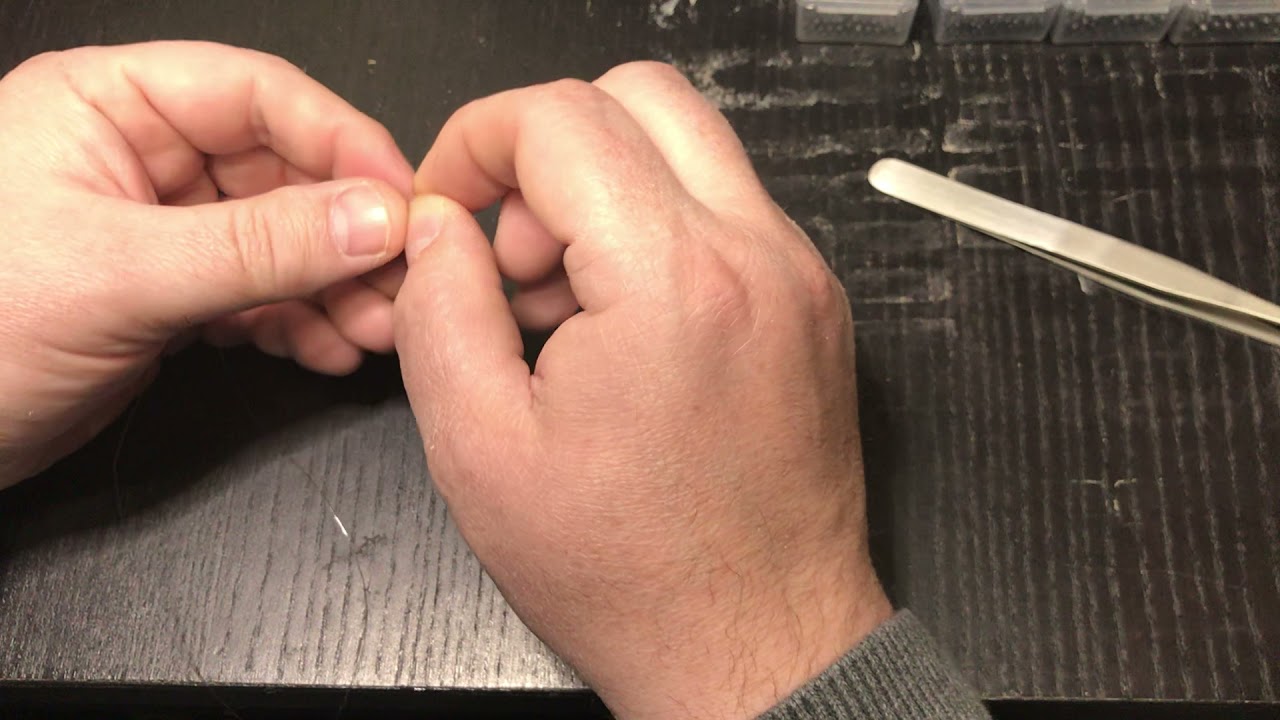 montage dacron en réponse à ricci