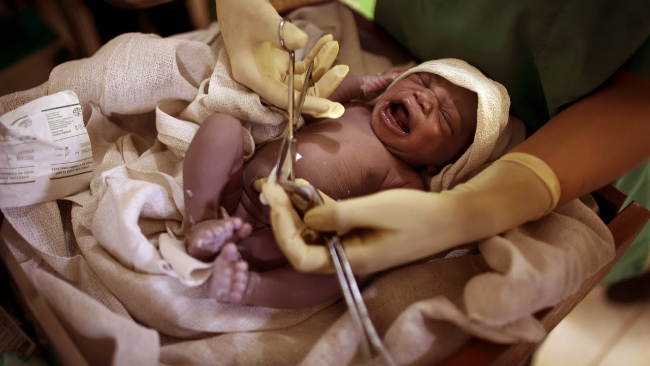 Tardar en cortar el cord&oacute;n umbilical tiene beneficios para el beb&eacute;