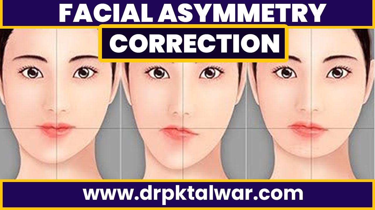 Asymmetrical Face, Fix Facial Symmetry With Fat Injection, Bone Graft And Implant | Dr PK Talwar