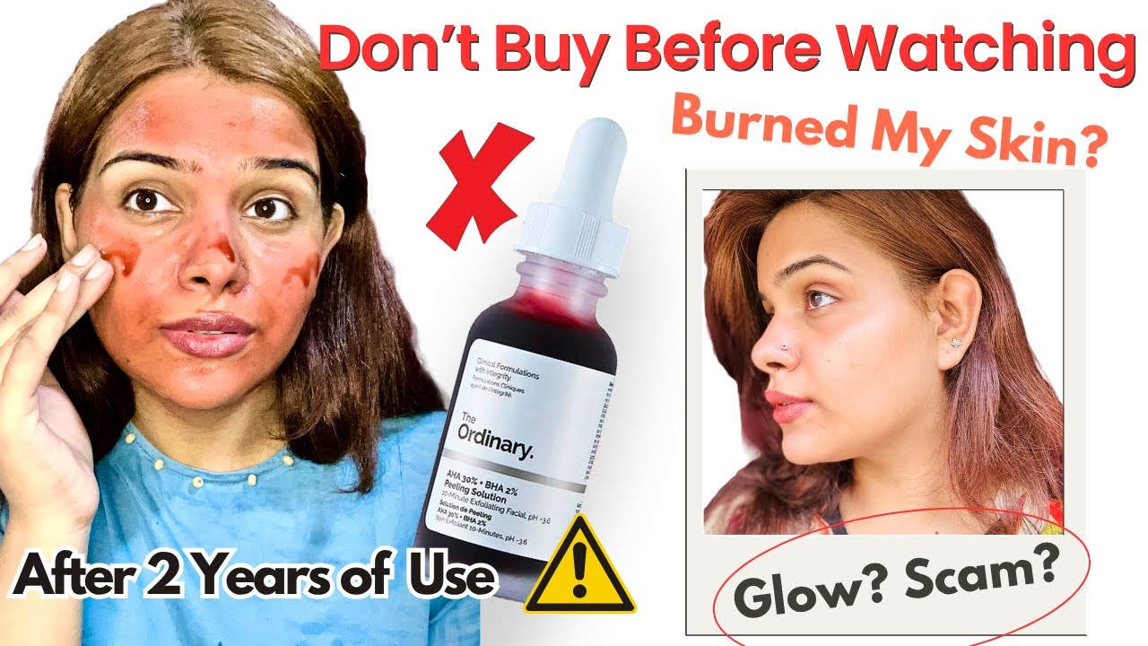 I Tried 10-Min Exfoliating Facial at Home for 2 YEARS | The Ordinary AHA BHA Peeling Solution Review