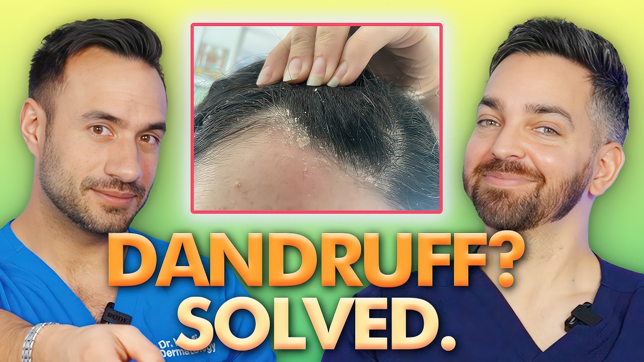 8 Dandruff Hacks that Will Change Your Life | Doctorly&rsquo;s Guide