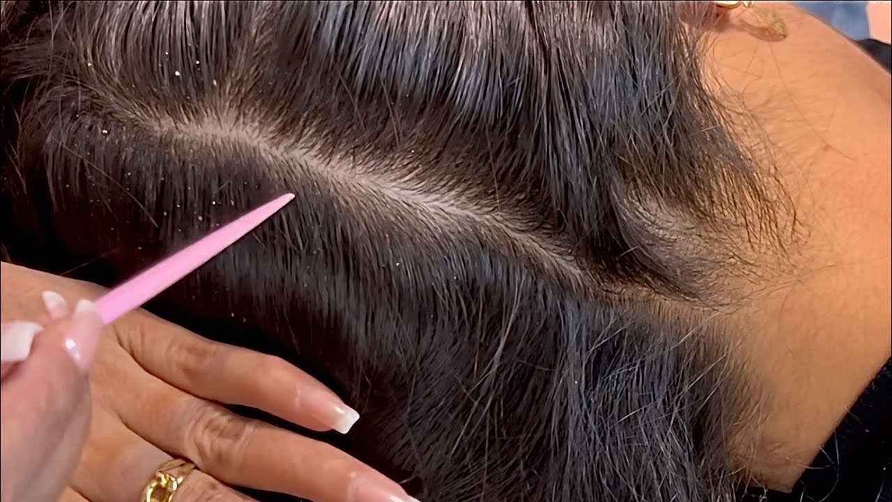 ASMR NITPICKING | Scalp Scratching and Scalp Check Asmr [ For Deep Sleep 😴 ]