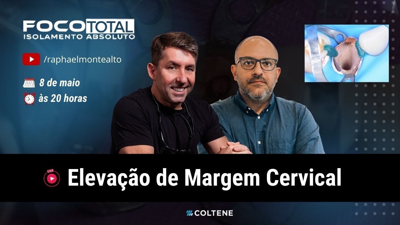 FOCO TOTAL - LIVE 5 - Elevação de Margem Cervical