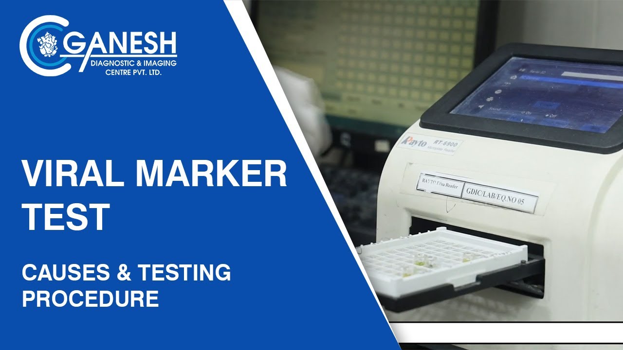 Viral Marker Test - Causes & Testing Procedure | Ganesh Diagnostic