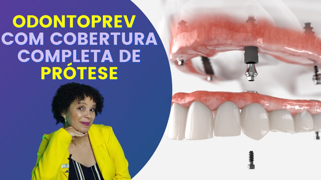 ODONTOPREV COM COBERTURA COMPLETA DE PRÓTESE