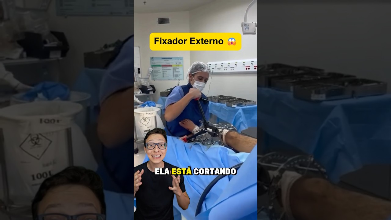 Fixador Externo 😱#medicina #medico #enfermagem #enfermeiro #enfermeira #ortopedia #ortopedista