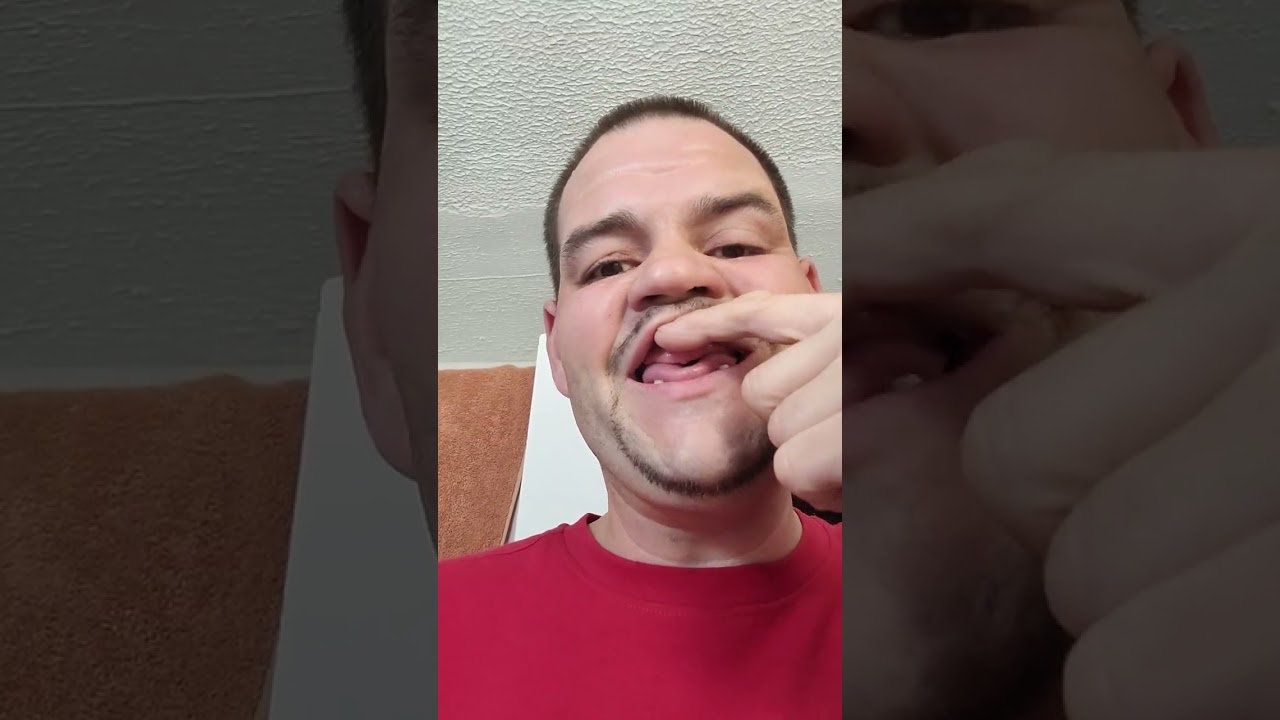 My personal experience without my dentures in.
