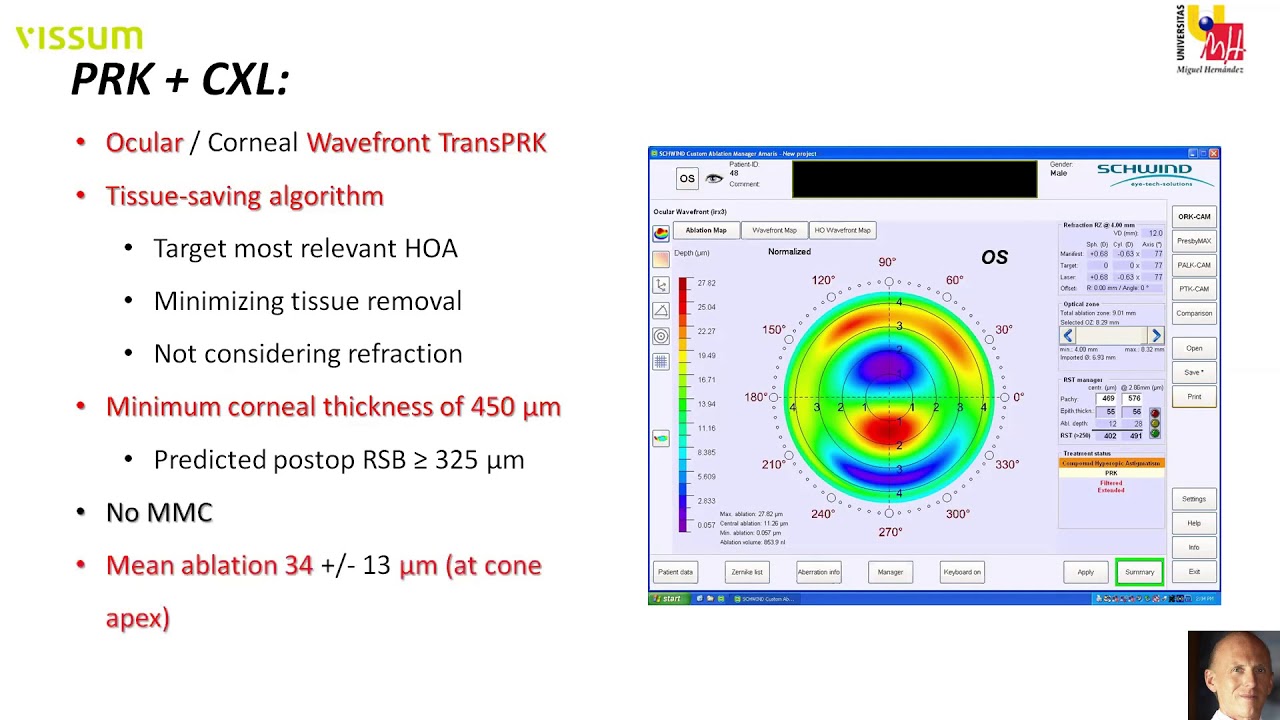 Optimizing PRK-CXL for Keratoconus | J. Alio