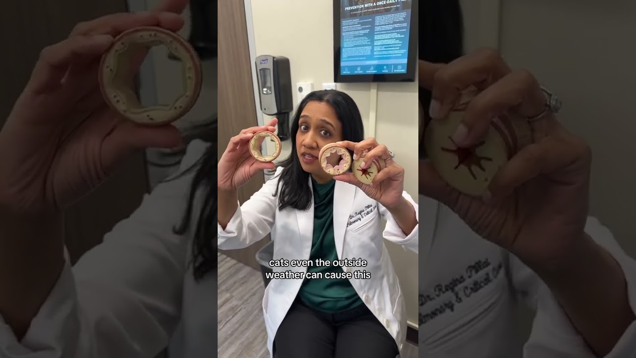 It&rsquo;s not easy being wheezy 🫁 pulmonologist Dr. Pillai explains #asthma