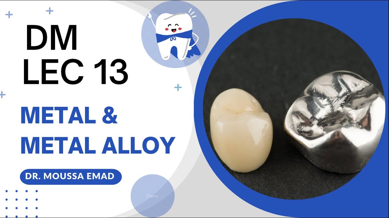لكجر 13 دي ام | Metal & metal alloys | طب اسنان مرحلة ثانية