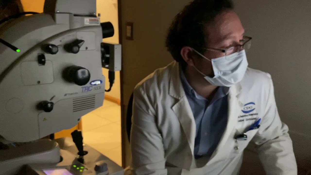 ANGIÓGRAFO 50 DX - TOPCON  (2º parte)