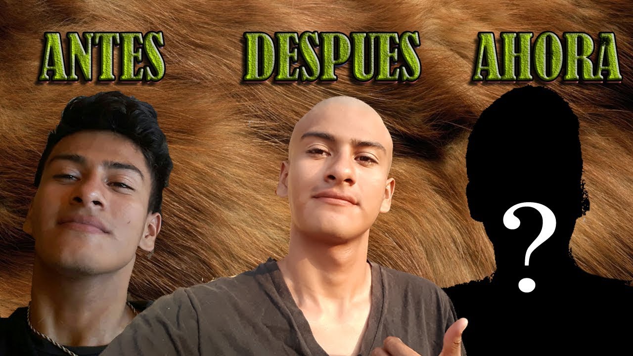 Crecimiento de Cabello |De Pelón a Pelo Corto| 1-90 Días|
