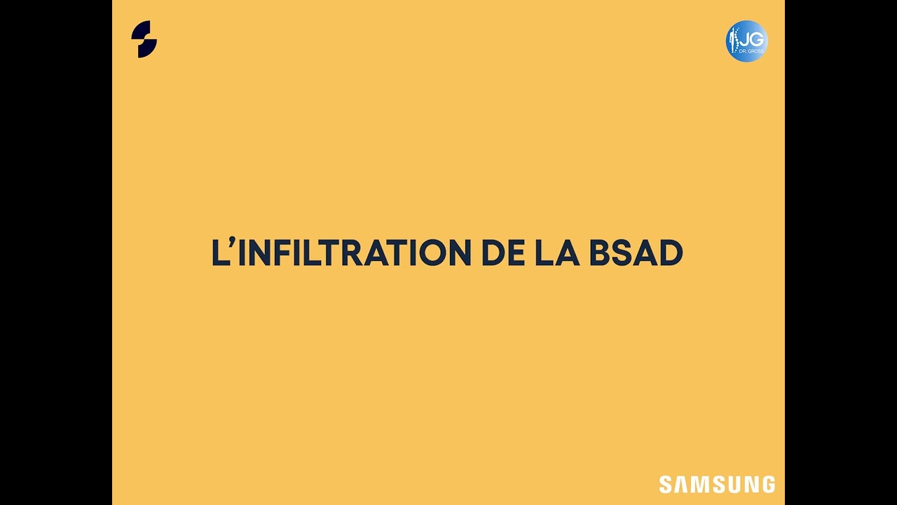 Infiltration échoguidée épaule / bourse sous acromiale