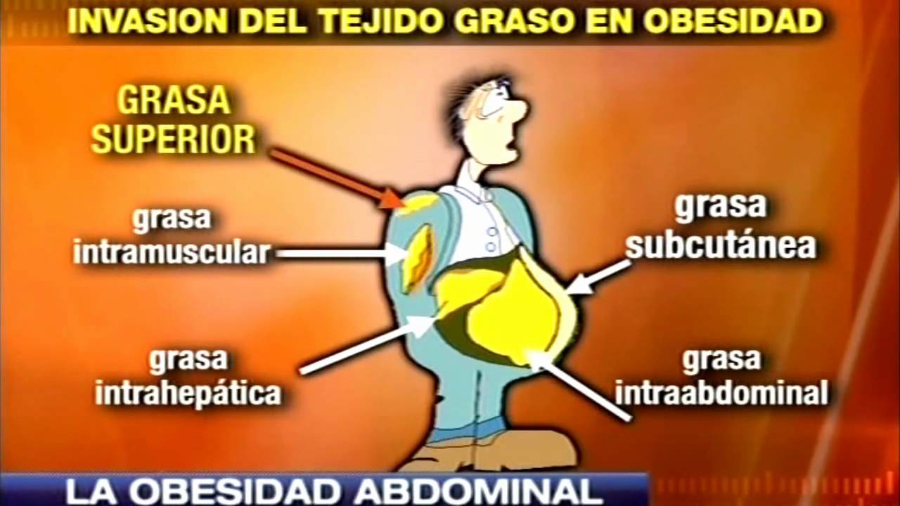 Dr. Cormillot | Obesidad: tipos y complicaciones