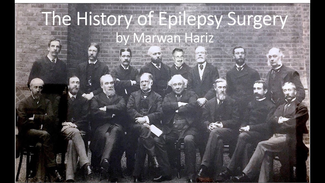 History of Epilepsy Surgery by Marwan Hariz
