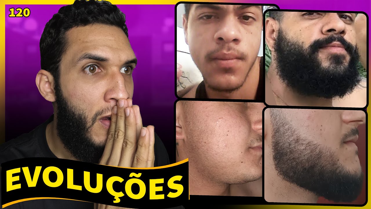 EVOLUÇÕES COM MINOXIDIL (resultados dos inscritos) #'120
