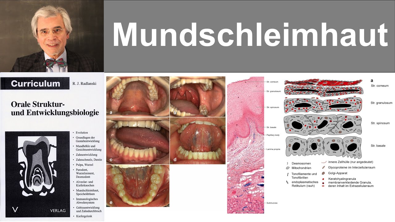 14 Mundschleimhaut