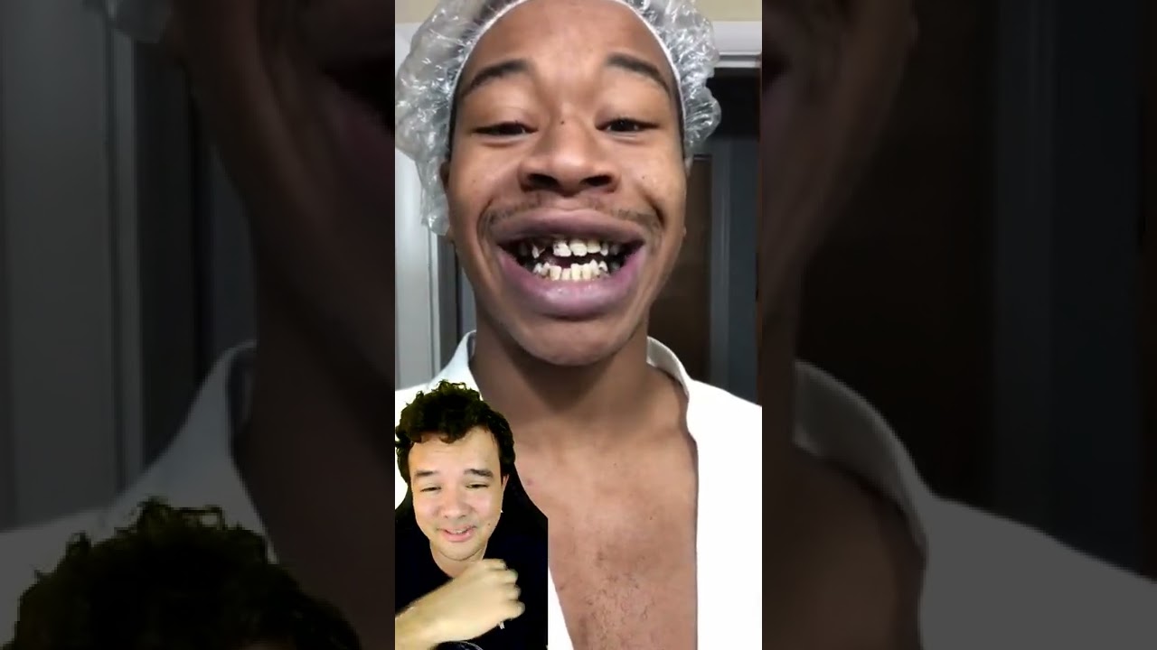 Ele tinha os dentes DETONADOS mas decidiu mudar de vida #shorts