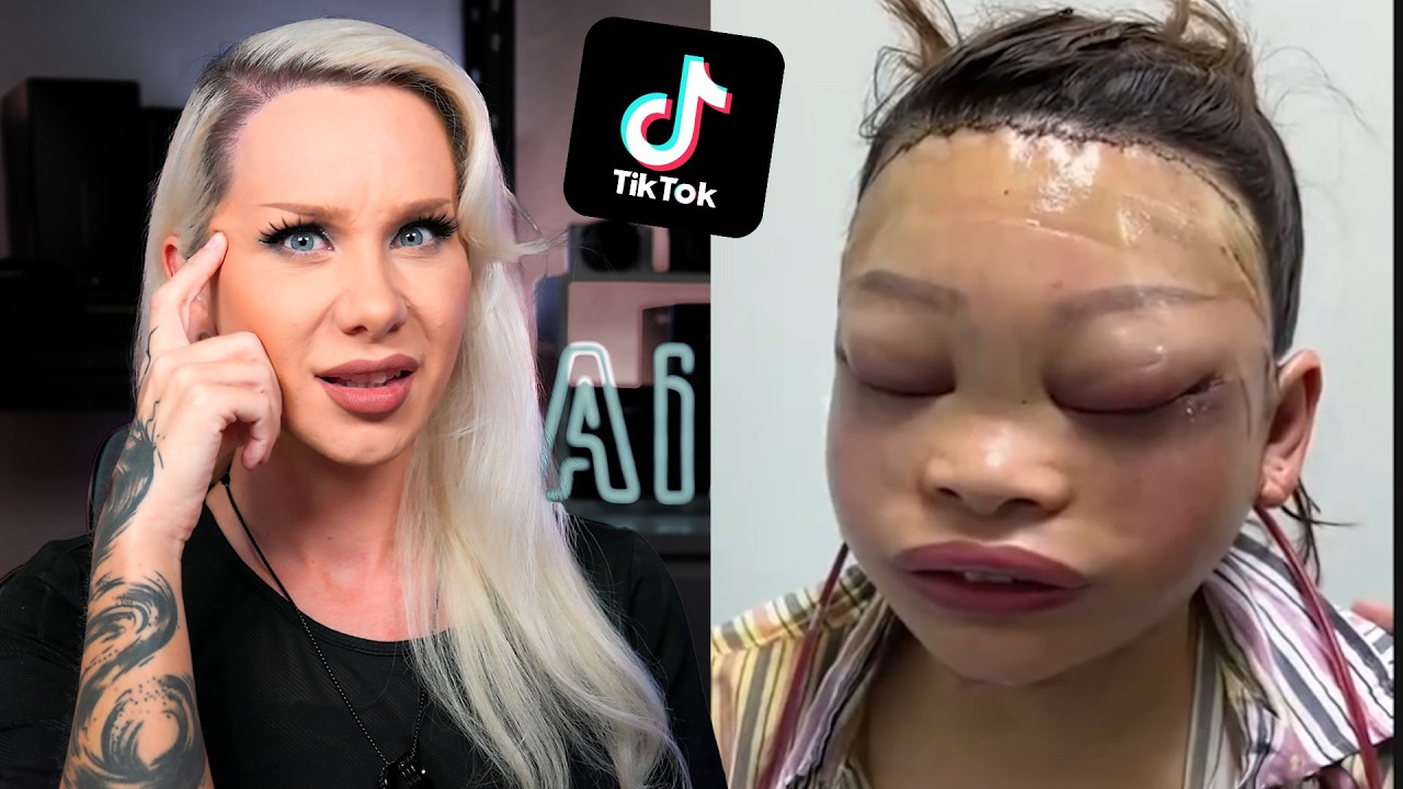 TikTok has a Plastic Surgery problem