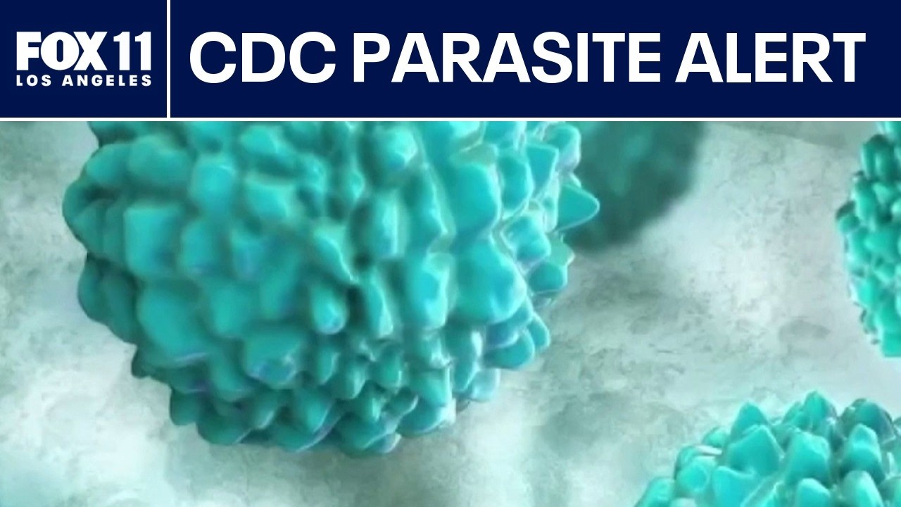 CDC investigates severe diarrhea parasite outbreak in 17 states