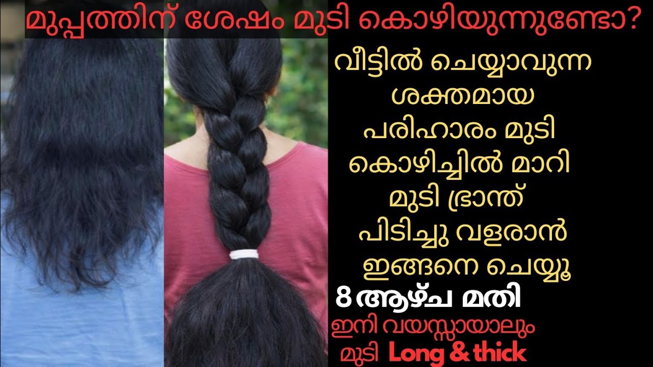 30 കഴിഞ്ഞാൽ Hair Fall നിർത്താൻ ഈ ഒറ്റ Routine മതി.മുടിയെ ഇരട്ടിയാക്കാം | Hair Fall Control After 30