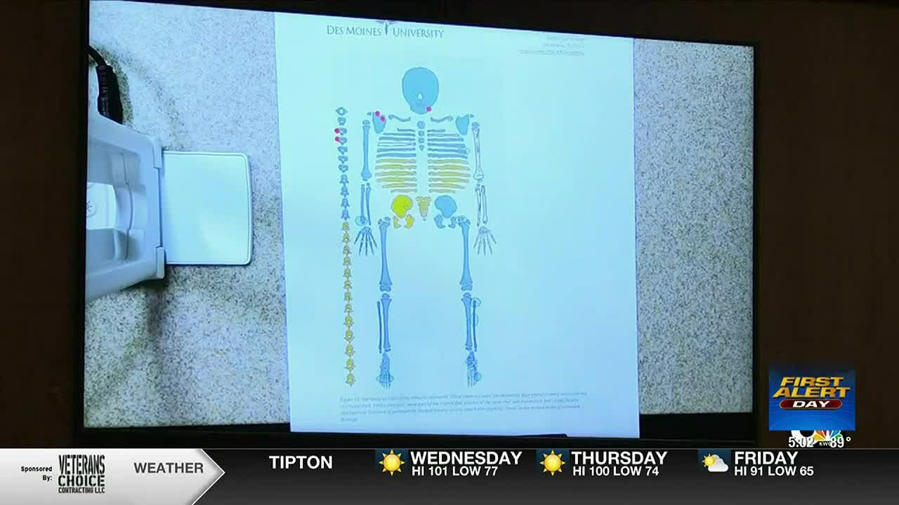 Forensic anthropologist who studied skeleton testifies in Henry Dinkins trial