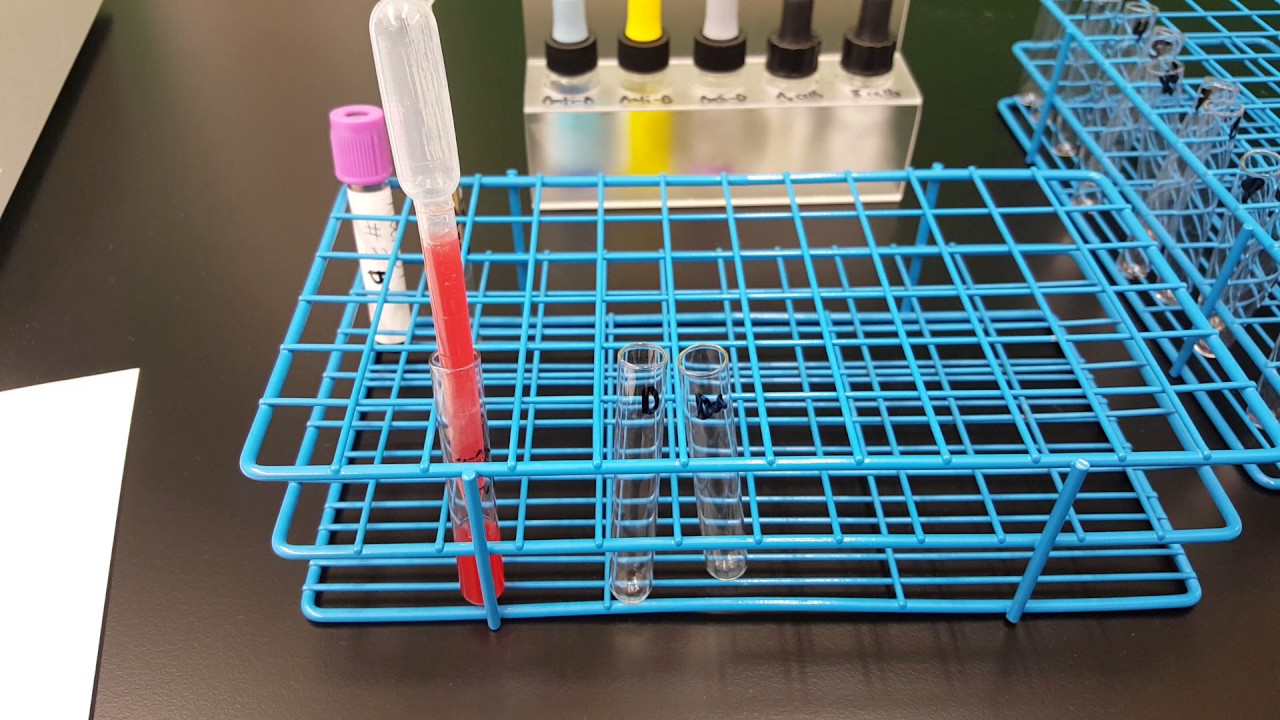 Blood Banking: Weak D test Part 1