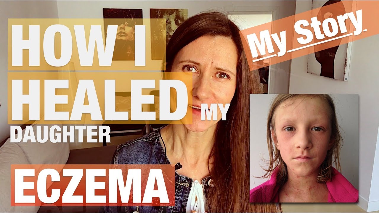 How I Healed My Daughter Eczema