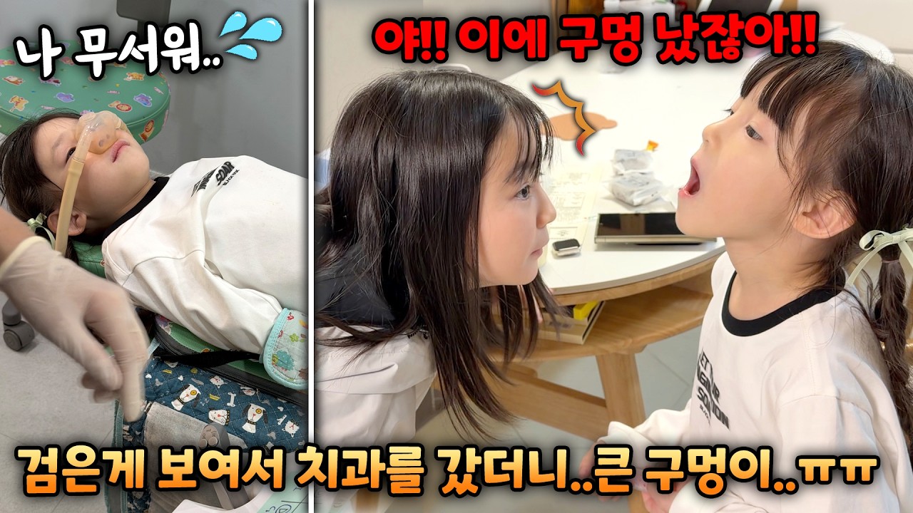 치아에 검은색이 보여서 치과를 갔더니 큰 구멍이..예설이 첫 충치치료;; 