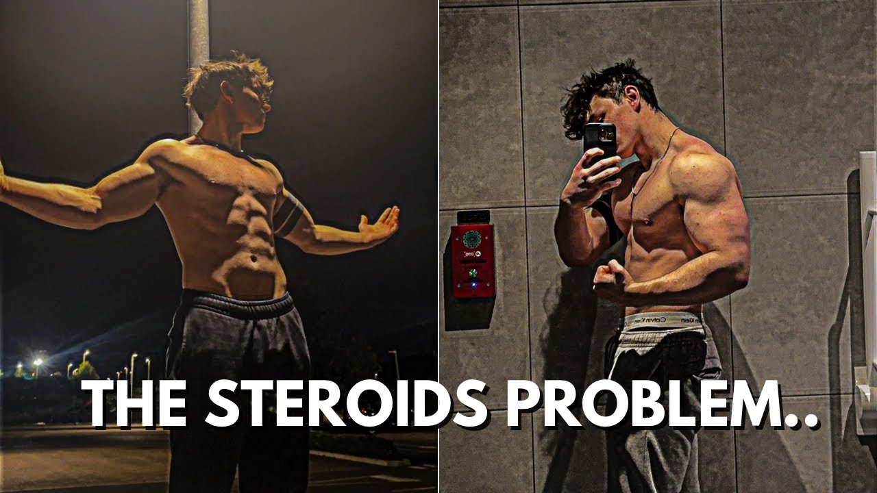 Why I Will NEVER Take Steroids (And You Shouldn’t Either)
