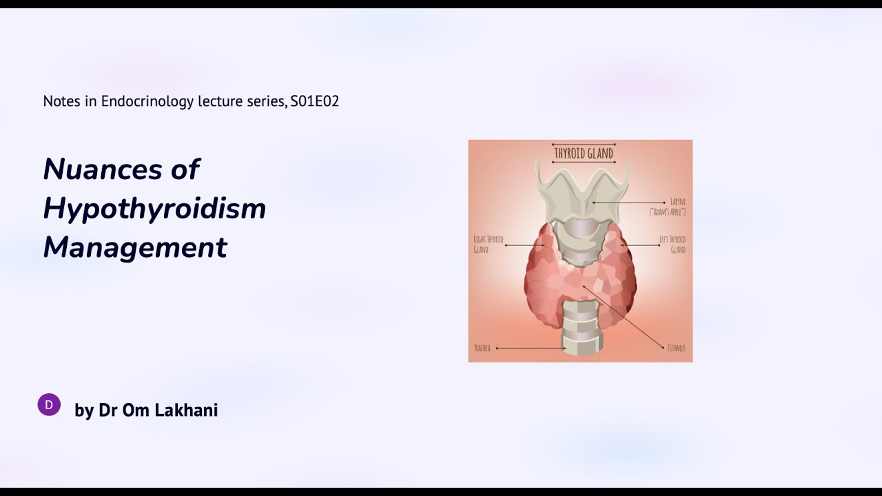 Nuances of Hypothyroidism Management