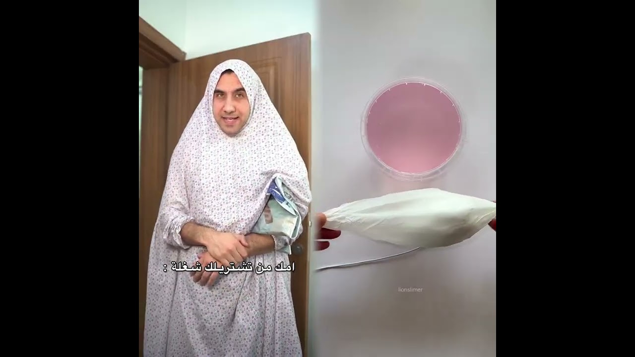 #الطفل الاعمى المعجزه #محضوره_من_الاكسبلور_والمشاهدات #علاوي_مارتن #اكسبلور 15_w