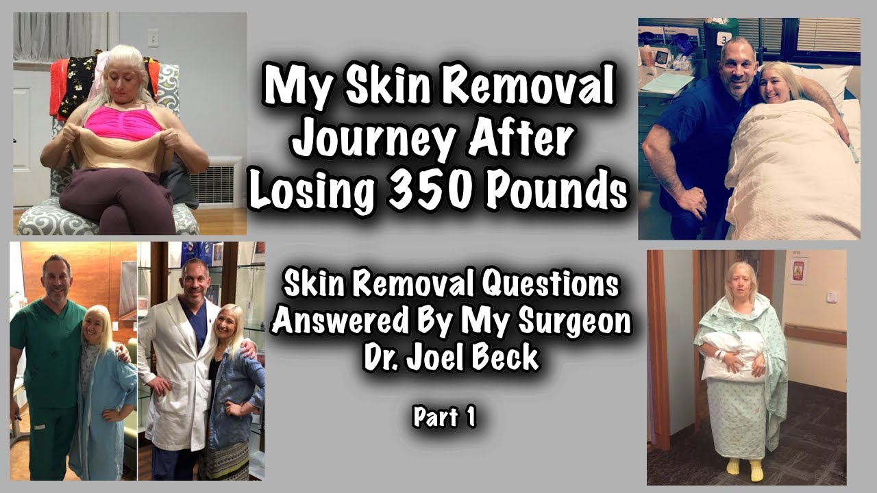 My Skin Removal Journey After Losing 350 Pounds || Skin Removal Questions Answered By Dr. Joel Beck