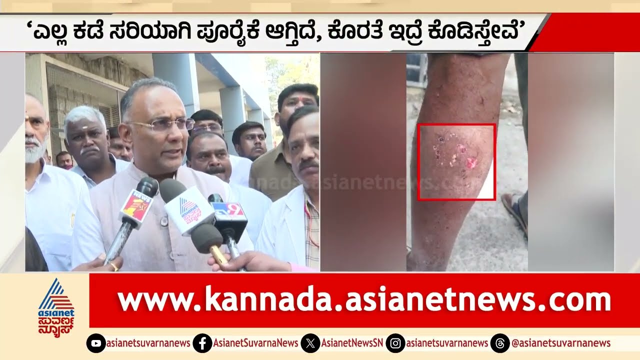 ರೇಬಿಸ್ ಇಂಜೆಕ್ಷನ್ ಸಿಗ್ತಿಲ್ವಾ? ದಿನೇಶ್ ಗುಂಡೂರಾವ್ ಸ್ಪಷ್ಟನೆ | Rabies vaccine shortage | Suvarna News