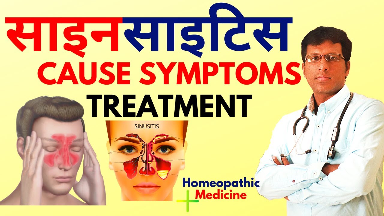साइनसाइटिस ? chronic sinusitis treatment | Sinusitis homeopathy treatment in hindi by Dr mahesh