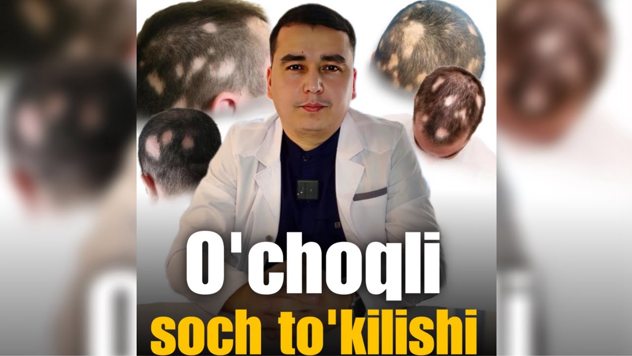 O’choqli soch to’kilishi | Dr.Abduvaliyev
