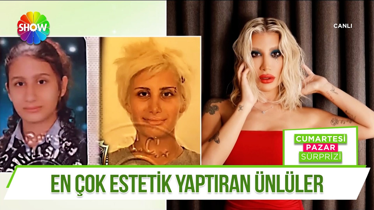 Estetik operasyonların en &ccedil;ok değiştirdiği isimler!