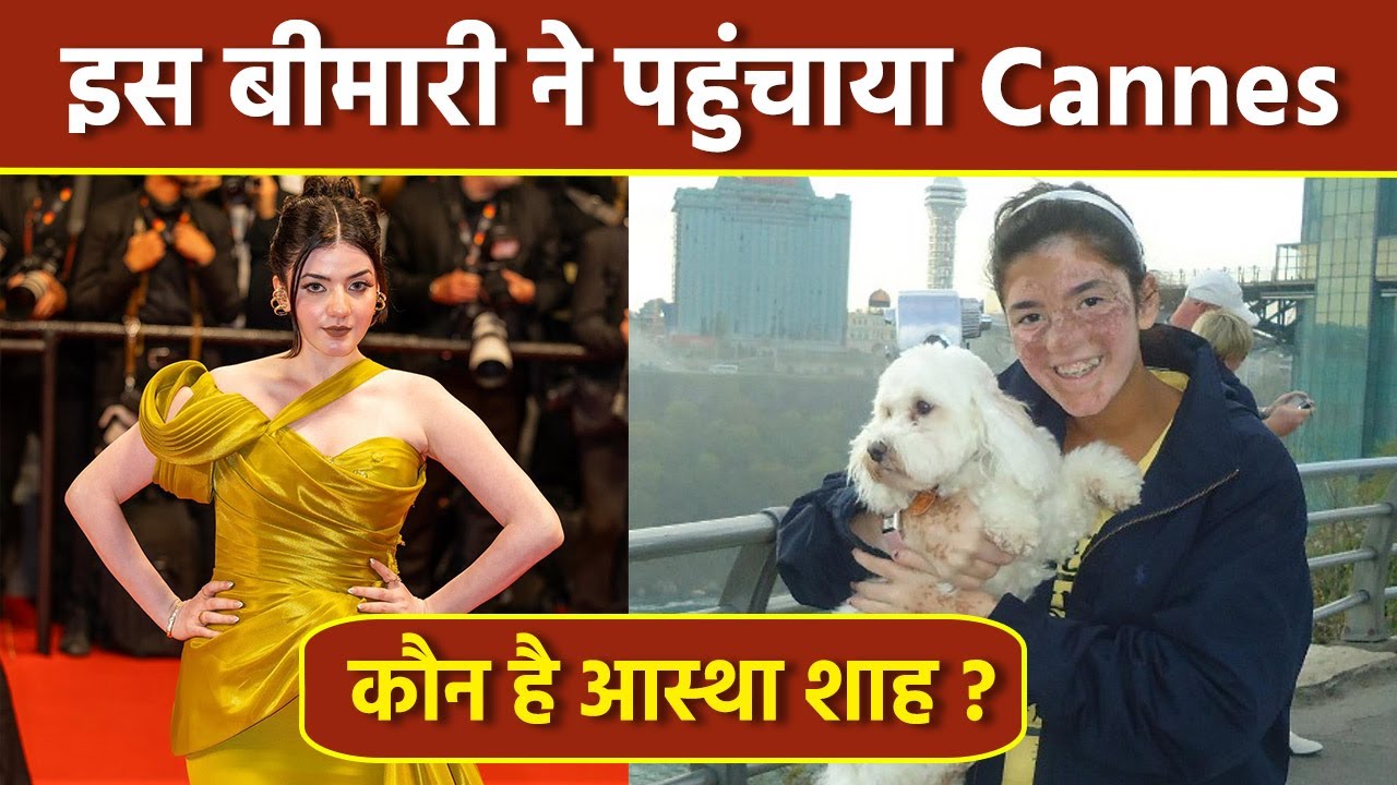Cannes 2024: Aastha Shah Vitiligo Disorder से Cannes Red Carpet Walk तक, Inspiring Life Story Reveal