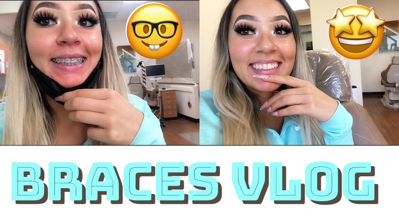 GETTING MY BRACES OFF VLOG ( THE PROCESS )