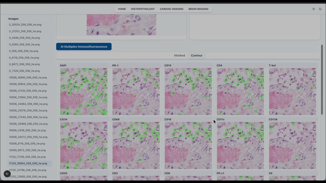 MEDICAL AI - AI for Multiplex Immunofluorescence in Histopathology