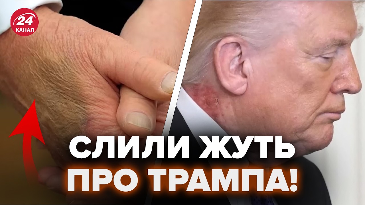 😮Трамп это СКРЫВАЛ до последнего! Смотрите, ЧТО С ПРЕЗИДЕНТОМ. Тайна Белого дома РАСКРЫТА