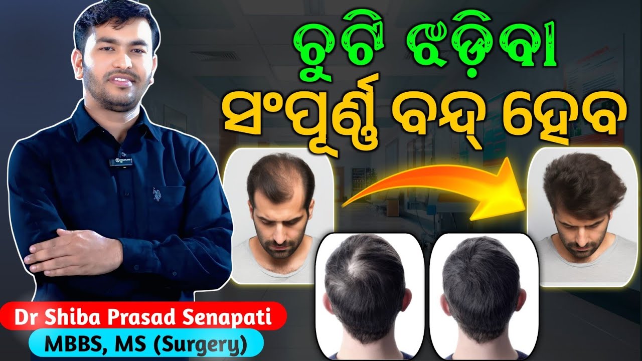 ଚୁଟି ଝଡ଼ିବା ସମ୍ପୂର୍ଣ ବନ୍ଦ୍ ହେବ#hairfall#odiahealthtips