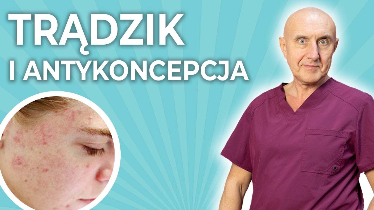 Wpływ antykoncepcji na trądzik.