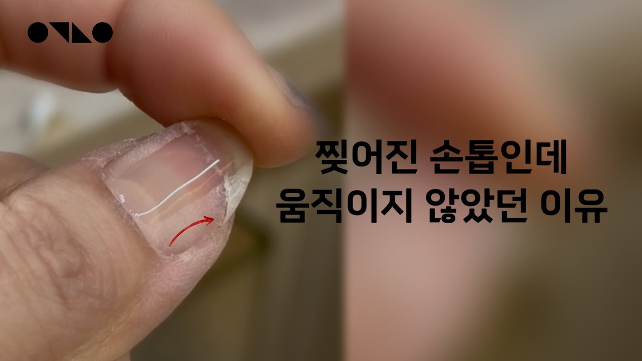 찢어진 손톱인데 안 움직입니다 | 젤의 종류보다 중요한 것