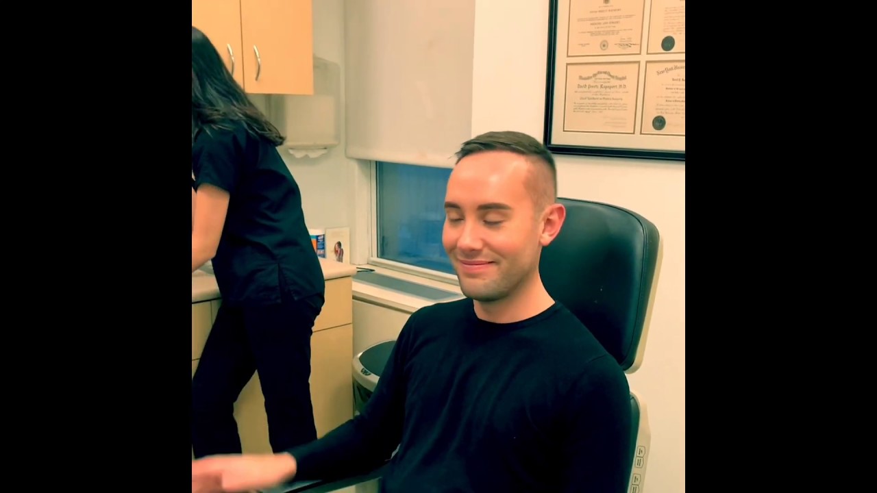 John's 1 Year Follow Up to Neograft Hair Restoration | Dr. David P. Rapaport NYC