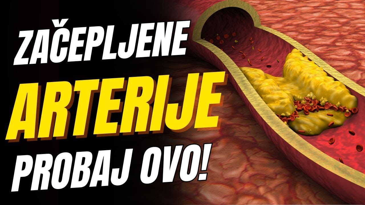 Ova hrana otpušava tvoje arterije – istina koju lekari retko kažu!