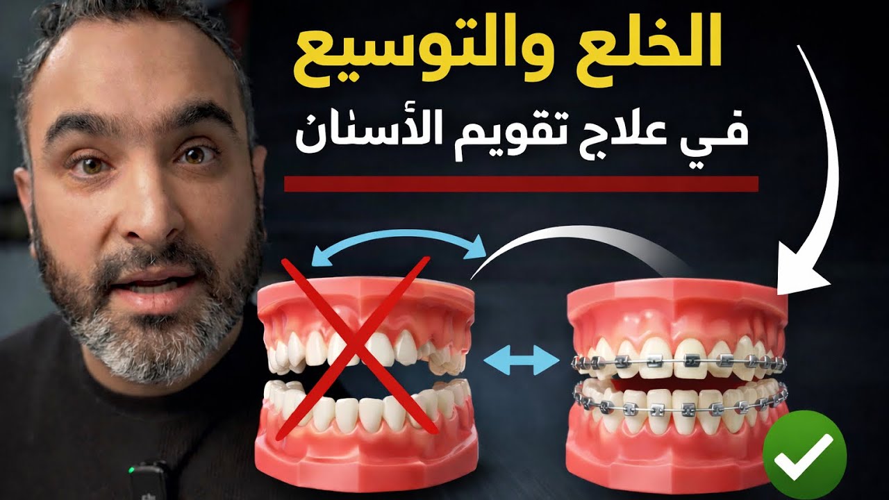 قلع الأسنان مع التقويم صار من الماضي ! 